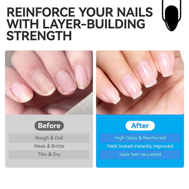 Dr. Kaiwart Nail Strengthener and Growth – 8‑in‑1 Nail Repair Treatment with Keratin, Collagen & Jojoba Oil | Nail Ridge Filler & Base Coat for Weak, Brittle Nails | 10ml