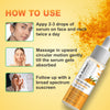 Dr. Kaiwart Dark Spot Clearing Turmeric Face Serum with Glycolic Acid & 2% Niacinamide – Brightening & Blemish Care for Clear, Radiant Skin – 30ml