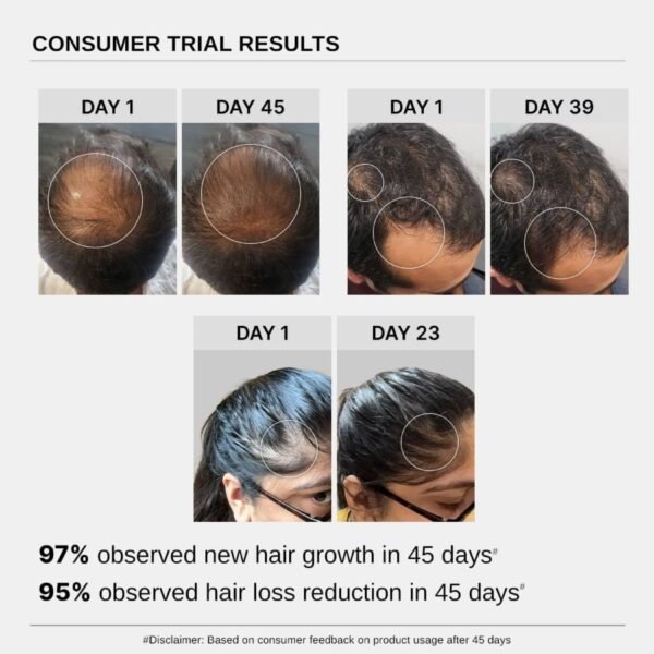 Dr. Kaiwart Advanced Hair Growth Serum For Hair Fall Control | Redensyl 3% + Anagain 4%  (30 ml) - Image 3